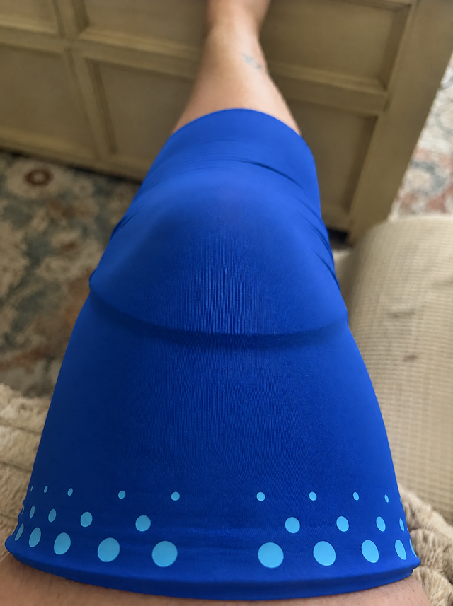 Kundenfoto: Eisbein am Knie im Wohnzimmer
